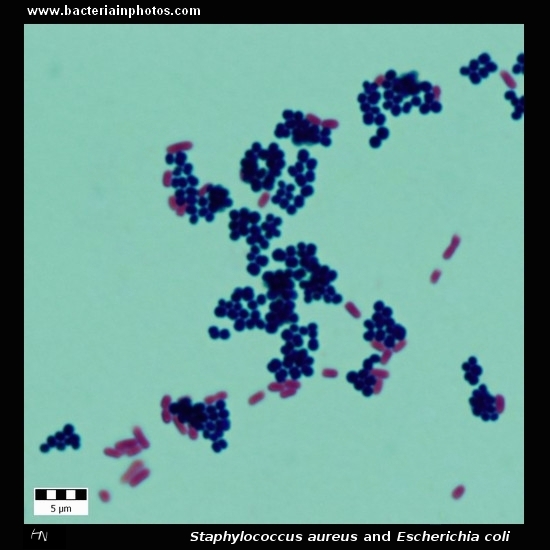 Staphylococcus aureus and E.coli   
                         microscopy, gram-positive and gram-negative bacteria